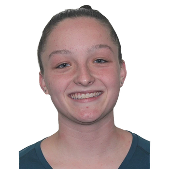Alyssa BURGESS