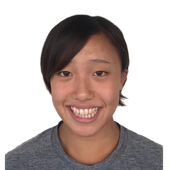 Hazuki MIYAMOTO | Profile | World Aquatics Official