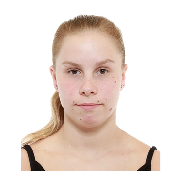 Ronja RUNDGREN